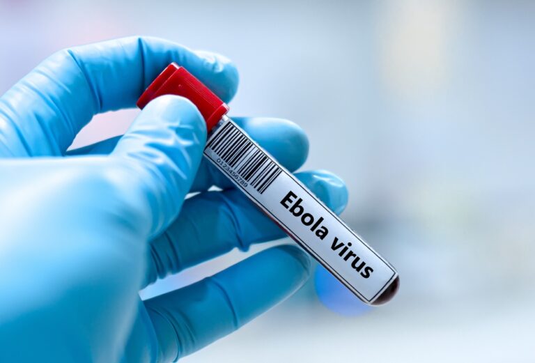 Blood,Sample,Tube,For,Ebola,Virus,Test,Analysis.